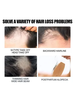 EELHOE Копър за здравословен растеж на косата Натурална растителна копър Може да се възстанови повредена коса Овлажняващ етерично масло в корените на косата